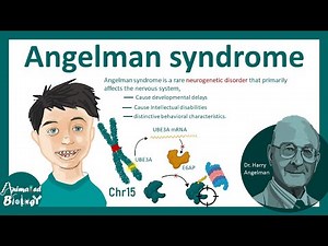 Angelman syndrome | Molecular basis of Angelman syndrome| pathology & genetics of Angelman syndrome