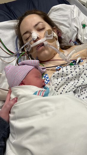 Emergency Bedside C-Section: A Life-Saving Procedure