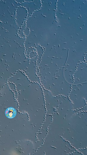 Jam's Germs on Instagram: "Real-time footage of really fast bacteria! . Hello everyone! These are some corkscrew-shaped bacteria called spirochetes and the way they move is quite fascinating. . The term spirochete defines probably thousands of different species, so it’s a general definition of the corkscrew-shaped bacteria. They move by rotating, just like a corkscrew moves forward when you try to open a bottle of wine. . Obviously, if you put your corkscrew (no pun intended) into a bathtub and 