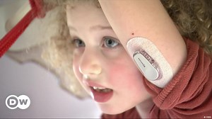 Fully automated insulin dosing helps Type 1 diabetics