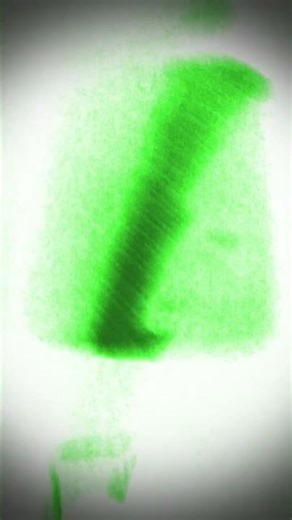 ZOREX IS BACK IN THE GAME