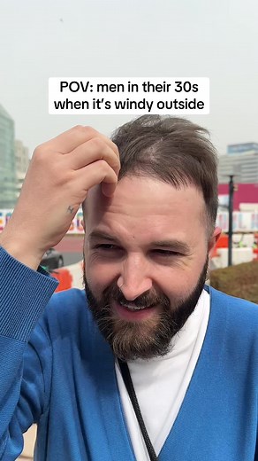 Booking a Trip to Turkey for Balding Men