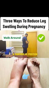 Leg swelling during pregnancy is one of the most common signs during advanced stage. Hence, every pregnant mother needs to know how to reduce it. | Dr.Moyub Healthcare