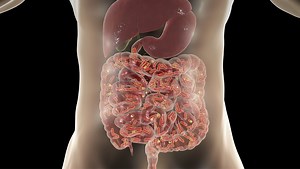 SIBO Solutions: A Guide to Recognition, Diagnosis, and Treatment