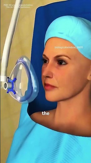 How Shoulder Joint Replacement Surgery Is Performed (3D animation) #music #digitalortho