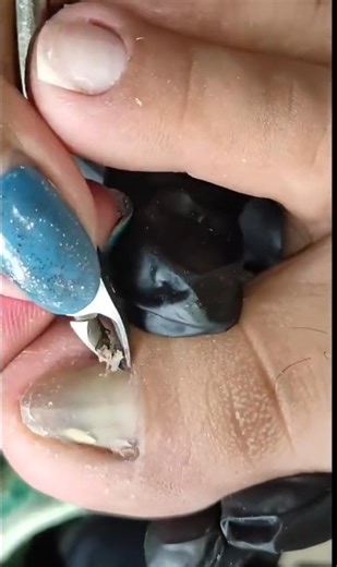 1K views · 11 reactions | LẤY KHÓE SIÊU PHÊ MỜI CẢ NHÀ CÙNG XEM, NHẮN TIN EM ĐỂ EM TƯ VẤN BỘ LÀM MÓNG LẤY KHÓE , NÂM MÓNG DƯỠNG MÓNG . #laykhoe #laykhoemong #laykhoemongchan #laykhoechan #laykhoeda | Lấy khoé Cực Phê | Facebook