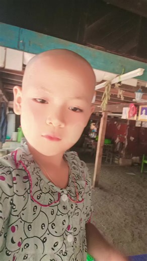 မူရင်းအသံ - ANONIMUS{Official} - Barış reus ပါဝင်သည့် 👑Su Su👑 (@hsu.hsu5302) ၏ ဗီဒီယိုများ