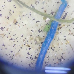 13K views · 282 reactions | Scientists found microplastics in human blood for the first time — but they know very little about how they affect us and if they will ever go away. | DW News | Facebook