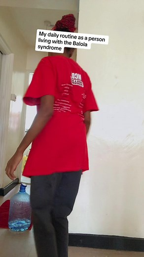 Understanding Balola Syndrome: Symptoms, Causes, and Realities