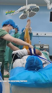 115K views · 253 reactions | #DoctorInAction #SurgeryInProgress #OperatingRoom #SurgicalPrecision #MedicalExcellence #SurgicalCare #OperatingTheater #HealthcareProfessionals #SurgicalTeamwork #SurgeryTime #MedicalProcedure #SurgicalSkills #PatientCare #InTheOR #SurgeryLife #DoctorCare #MedicalProfessionals #SurgicalSuccess #HealthAndHealing #BehindTheScenesInTheOR | Great Doctor | Facebook
