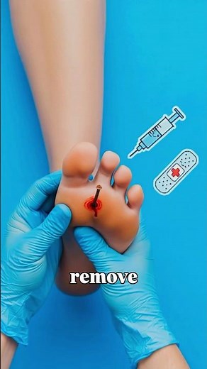 What If You Stepped on a Rusty Nail?