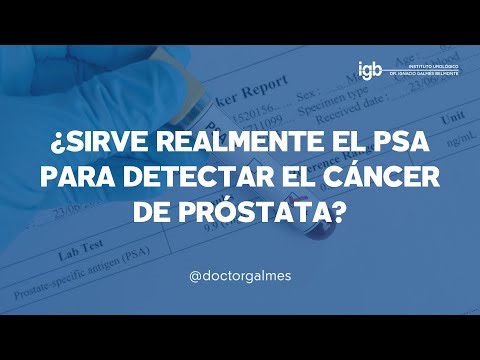 Sirve realmente el PSA para detectar el cáncer de próstata? | IGB