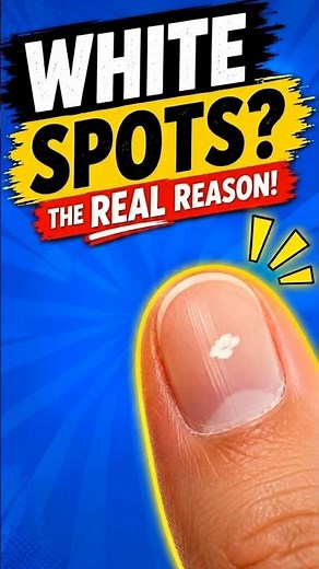 The Secret Reason Behind White Spots on Your Nails! #facts