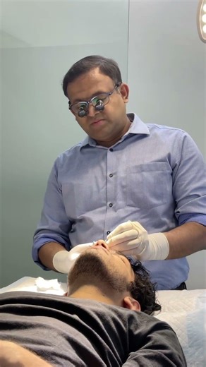 Facial Sutures Removal | Proper Closure = Better Scars | Plastic Surgeon Explains