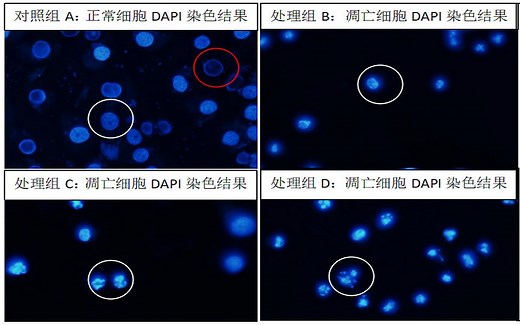 细胞生物学-紫外线诱导细胞凋亡和DAPI直接染色法