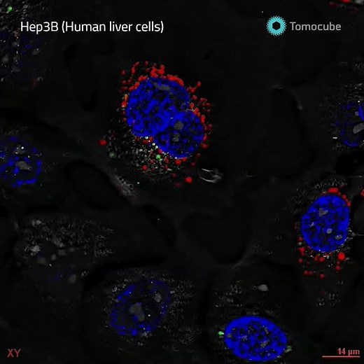 Correlative Holotomography & Fluorescent imaging of Human liver cell (Hep3B)