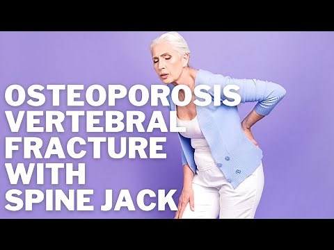 Osteoporosis Lumbar Vertebral Spine Compression Fracture causing back Pain: Spine Jack Kyphoplasty