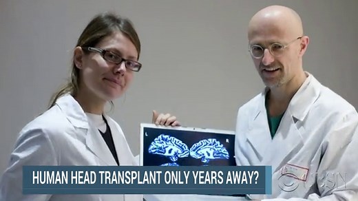 Doctors plan for world's first head transplant