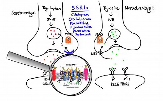 Antidepressants Nursing Considerations & Management - RNpedia