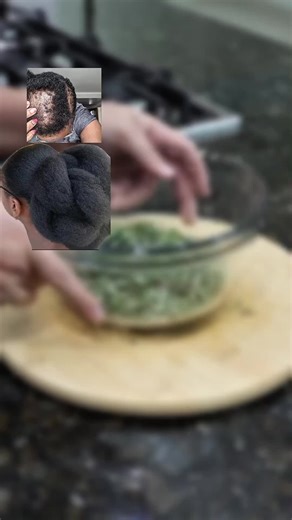 Remèd natirèl pou pouse cheve ou