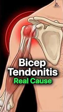 Biceps Tendonitis Keeps Returning #shoulderpain #rotatorcuff #shoulderrehab #shouldermobility #physi