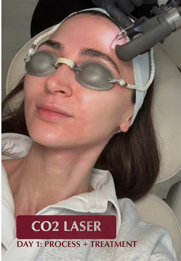 My CO₂ Laser Skin Treatment Journey: Healing Process