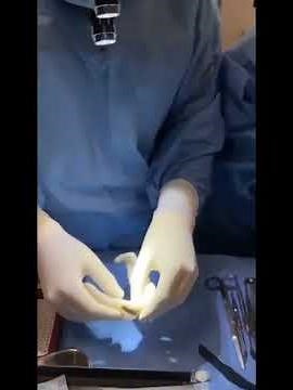 Jaw Surgery Transformation | Surgical Process & Before After Results | Dr Mathew PC
