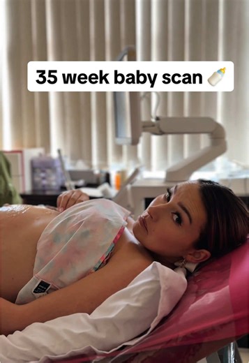 The Beneke’s 🇿🇦❤️ (@thebenekes) - 35 Week Baby Scan: What to Expect at This Stage