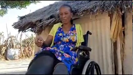 Seeking help... Elizabeth Joseph (43) is reaching out to the public for assistance. She said a snake bite in 2015 caused her to lose her arm and leg in 2018. "This year, my other leg started swelling and later turned black," she added. Video: Festus Hamalwa | New Era Newspaper