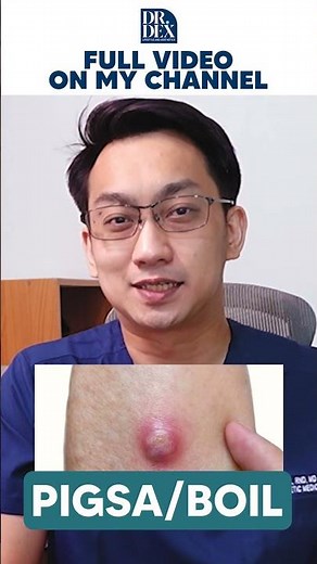 Usapan Pigsa! | Dr. Dex Macalintal
