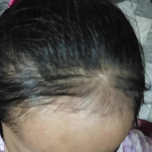 Effective Home Remedies for Everyday Ailments