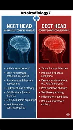 X-RAY TECHNICIAN 🥼🩻 on Instagram: "NCCT (NON CONTRAST COMPUTED TOMOGRAPHY) ​ Initial Stroke Protocol: Used to rule out bleeding before starting blood thinners. ​ Acute Trauma: Excellent for detecting skull fractures and immediate brain swelling. ​ Calcifications: Easily identifies hardened mineral deposits or metal artifacts. ​ CECT (CONTRAST ENHANCED COMPUTED TOMOGRAPHY) ​Pathology Detection: Better for highlighting tumors, masses, and abscesses. ​Vascular Health: Visualizes blood flow to ide