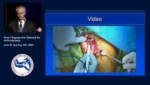 How I Expose the Glenoid for Arthroplasty: Tips and Tricks to Achieve Reproducible Glenoid Access