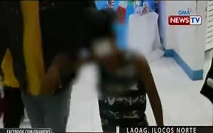 Batang lalaki, nasabugan ng baby rocket sa mukha; 1 pa, naputukan naman ng piccolo