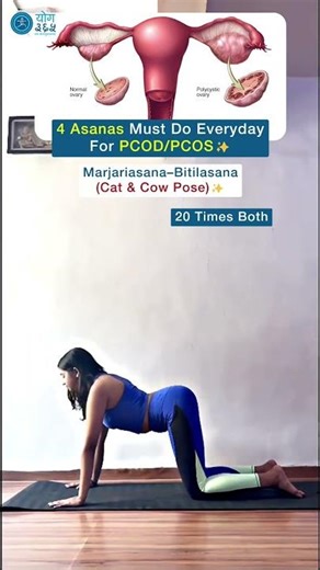 Beat PCOS Naturally with These 4 Yoga Poses!