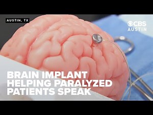 Austin's Paradromics advances Brain-Computer Interface with successful surgery