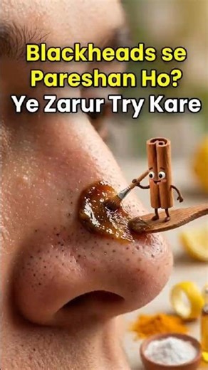 Whiteheads se pareshan ho ye nuskhe zarur try kro #shortsfeed #shorts #youtubeshorts
