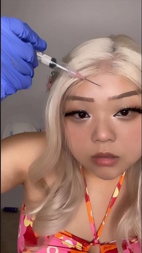 ASMR injecting my face with filler #asmrtingles #asmr