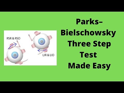 Parks Bielschowsky Three Step Test Made Easy