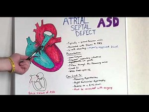 Atrial Septal Defect - Anatomy Lecture for Medical Students - USMLE Step 1