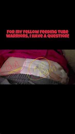 A call for help for fellow feeding tube warriors! #feedingtubefail #feedingtubepain #fyp #gtubehelp #gtubelife