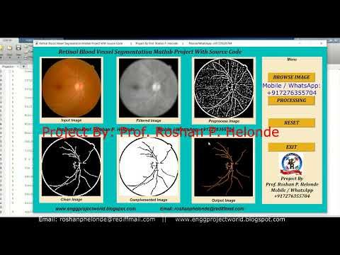 Retinal Blood Vessel Extraction In Fundus Images | Matlab Final Year IEEE Project VesselSegmentation