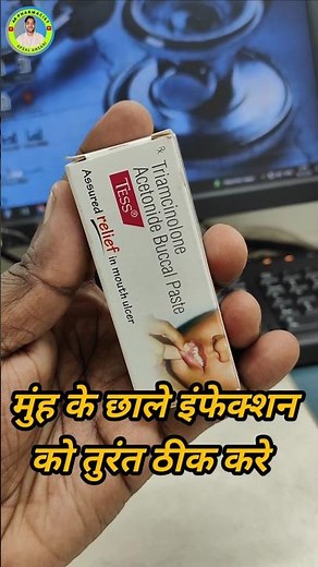 Tess paste benefits | Tess buccal paste use | Triamcinolone acetonoid buccal paste #trending #shorts