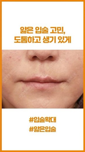 얇은 입술이 고민이라면? 필러 말고 '입술확대수술'! #그림성형외과 #구상환원장
