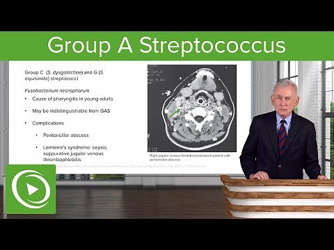 Group A Streptococcus (GAS): Symptoms & Other Clinical Features – Infectious Diseases | Lecturio