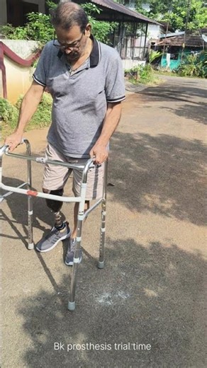 Reborn orthotics Thrissur..Bk prosthesis trial