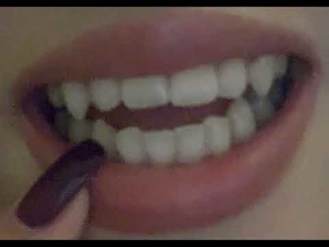 ⋆˙⟡🦷Fangs ⊹ ࣪ ˖sharp canines