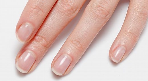Do You Know What Your Nails Can Tell You About Your Health?