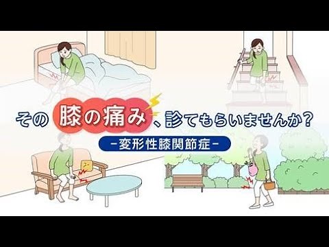 その膝の痛み、診てもらいませんか？ ―変形性膝関節症―