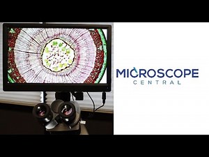 Using An LCD Screen With Your Microscope